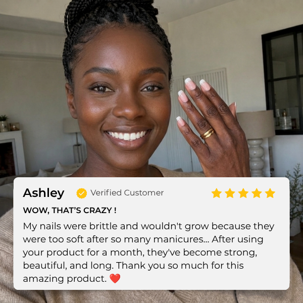 alluma. | Nail Growth Serum (Buy 1 Get 1 FREE)