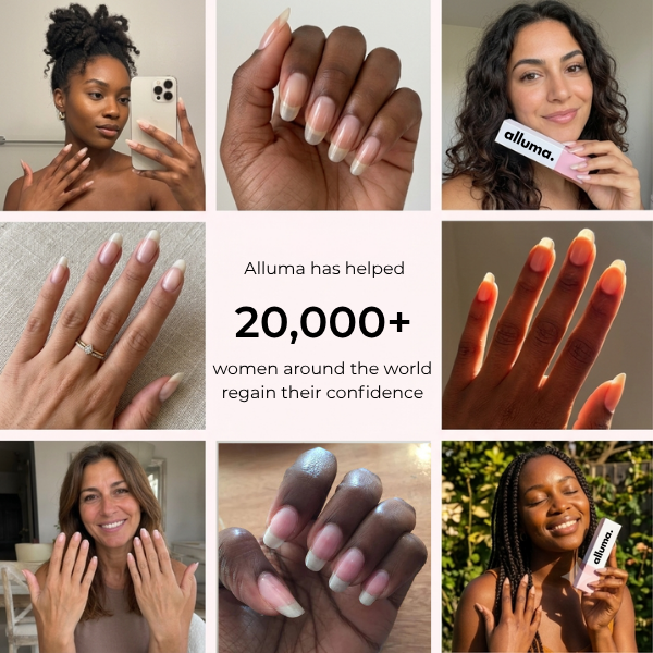 alluma. | Nail Growth Serum (Buy 1 Get 1 FREE)