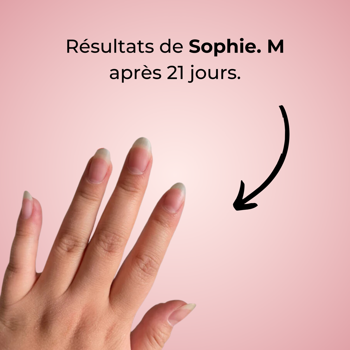 alluma. | Nail Growth Serum (Buy 1 Get 1 FREE)
