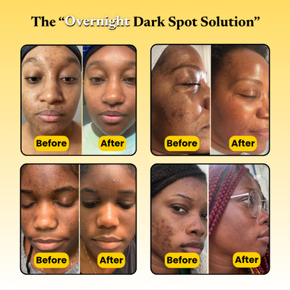 alluma. | Kojic Acid Turmeric Overnight Mask